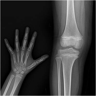 X-ray 검사
